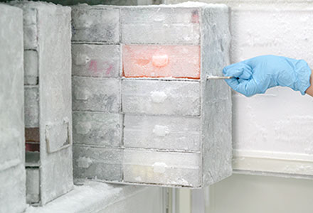 -20&deg; biostorage services